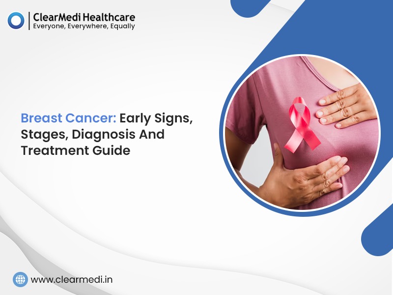 Breast Cancer: Early Signs, Stages, Diagnosis And Treatment Guide
