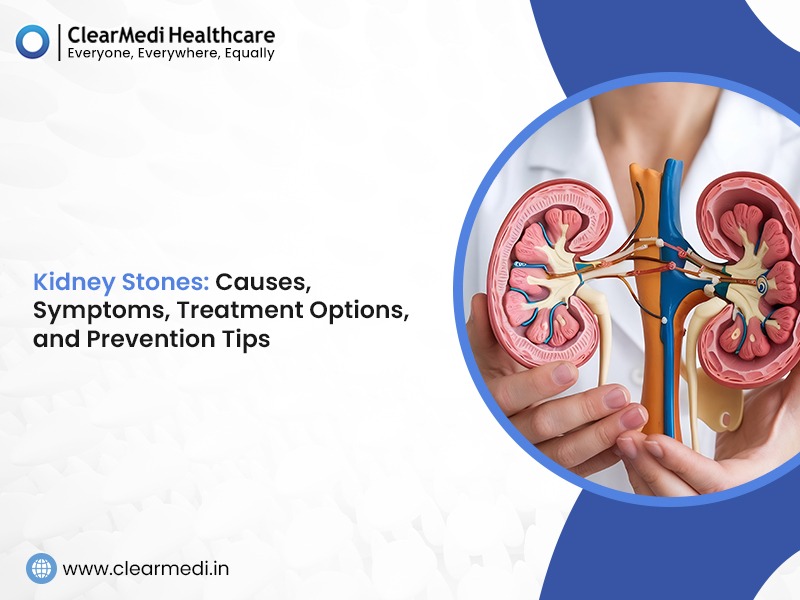 Kidney Stones: Causes, Symptoms, Treatment Options, and Prevention Tips 