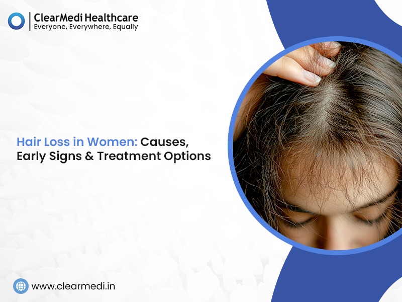 Hair Loss in Women: Causes, Early Signs & Treatment Options