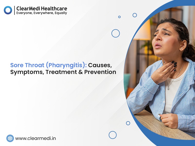Sore Throat (Pharyngitis): Causes, Symptoms, Treatment & Prevention