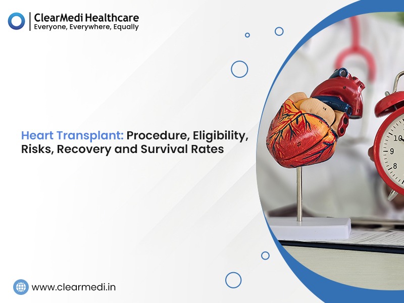 Heart Transplant Procedure, Eligibility, Risks, Recovery and Survival Rates