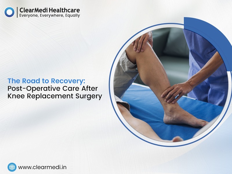 The Road to Recovery: Post-Operative Care After Knee Replacement Surgery