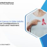 Breast Cancer in Older Adults: Unique Considerations in Diagnosis and Treatment
