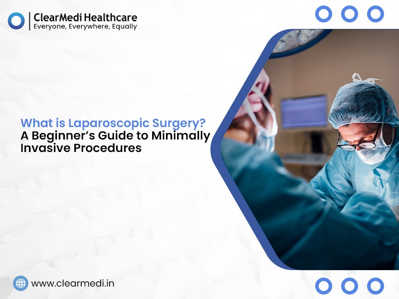 What is Laparoscopic Surgery?