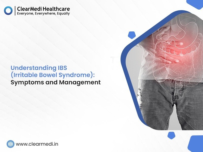 Understanding IBS (Irritable Bowel Syndrome): Symptoms and Management