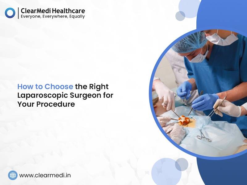 How to Choose the Right Laparoscopic Surgeon for Your Procedure